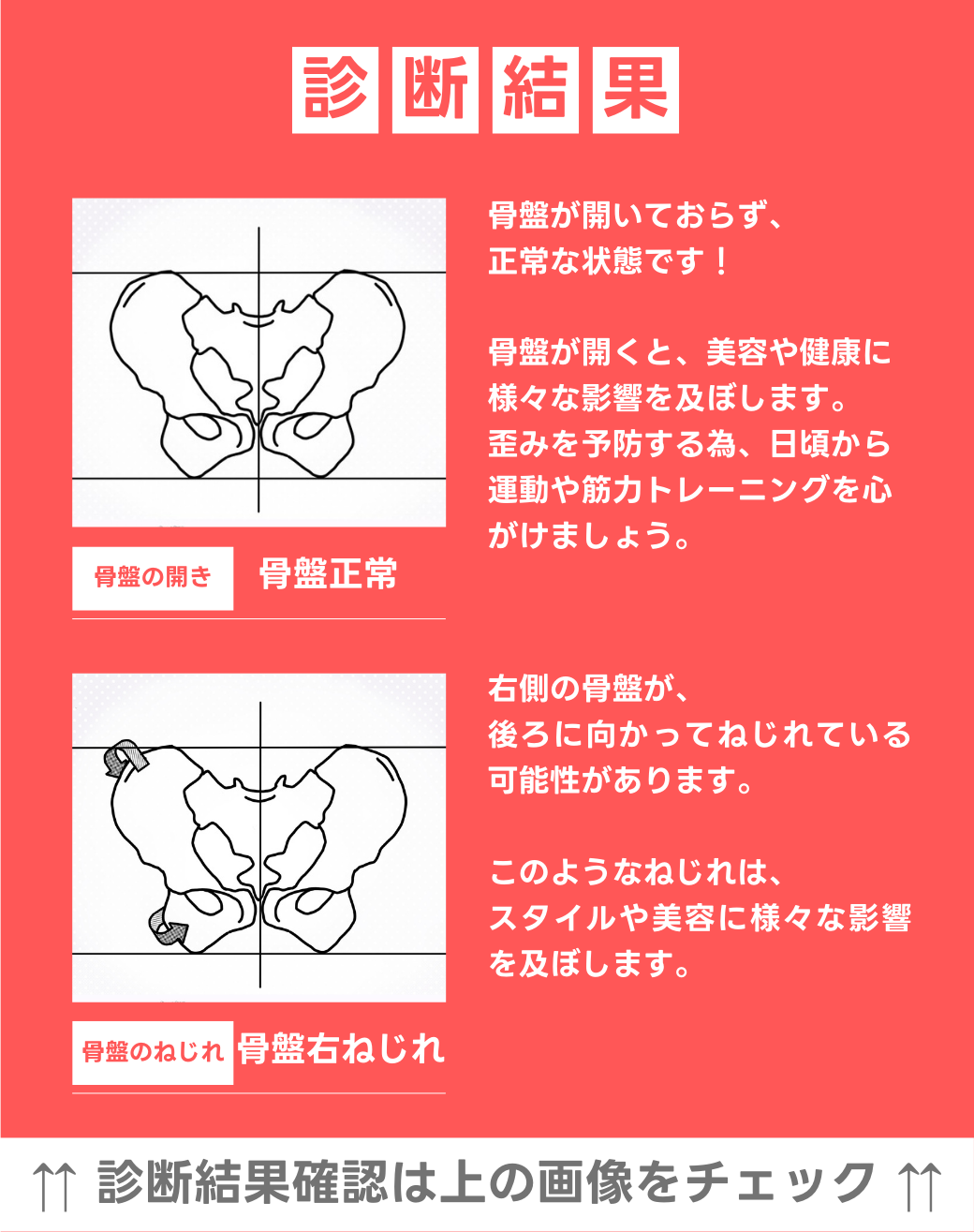 骨盤正常 右骨盤捻じれ